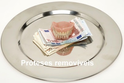 implantes dentários