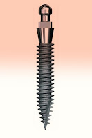 implantes e ortodontia